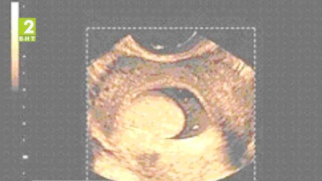 Безплатни профилактични прегледи в Русе