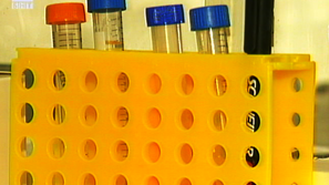 Светът е в пандемия от свински грип