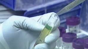 Три случая на свински грип във Варна