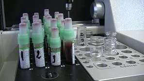 Няма промяна в нивото на разпространение на хепатити А