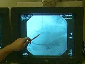 пари кардиоболниците