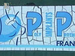 Европейски регулации за пазара на импланти