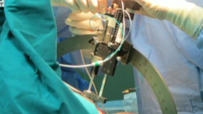 Първа мозъчна операция на болен от Паркинсон у нас