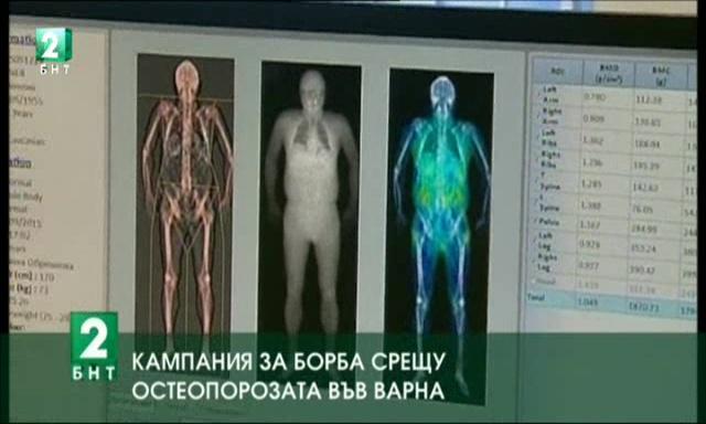Кампания за борба срещу остеопорозата във Варна