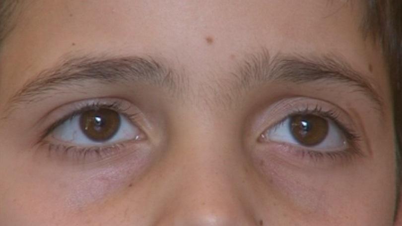 10-годишно момче от Куклен има нужда от помощ