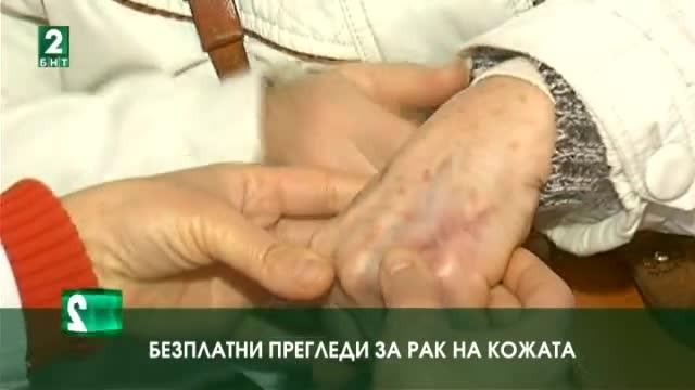 Безплатни прегледи за рак на кожата
