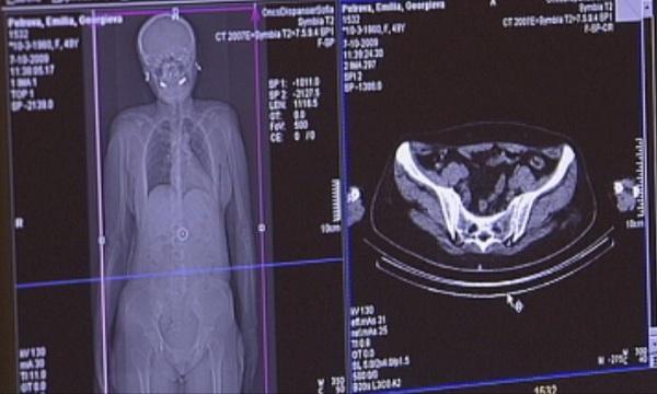 Нужна е дългосрочна стратегия за борба с онкологичните заболявания
