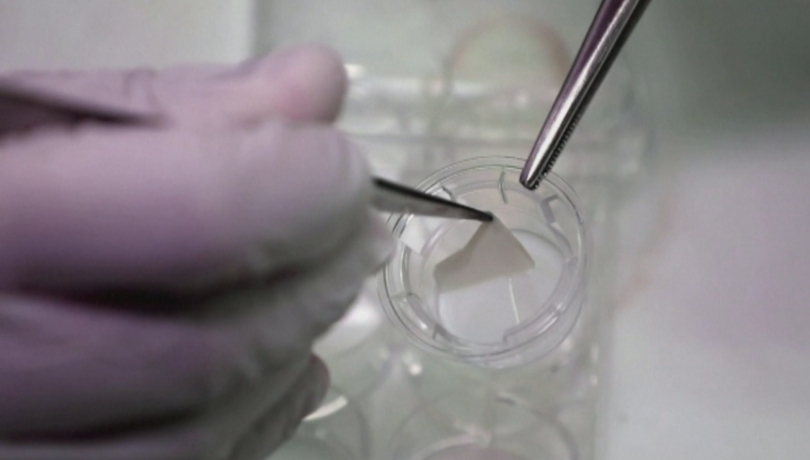 Създаване на човешка кожа с 3d принтер отдавана се