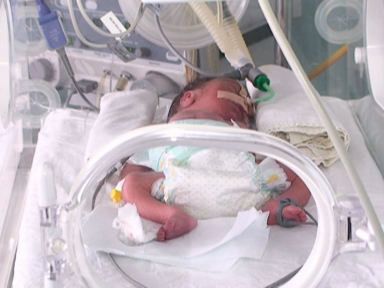 Профилактика за недоносените бебета